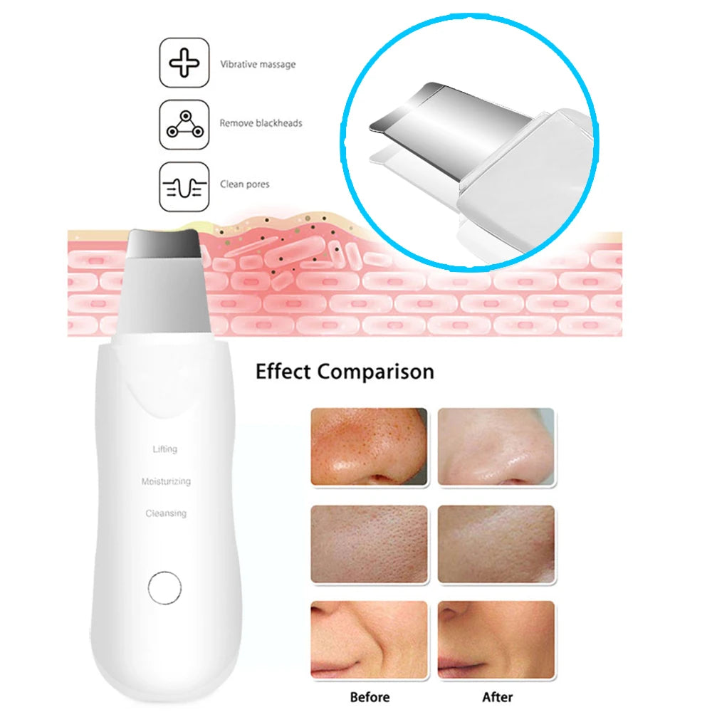 CAMMUO Ultrasonic Skin Scrubber Scrubber