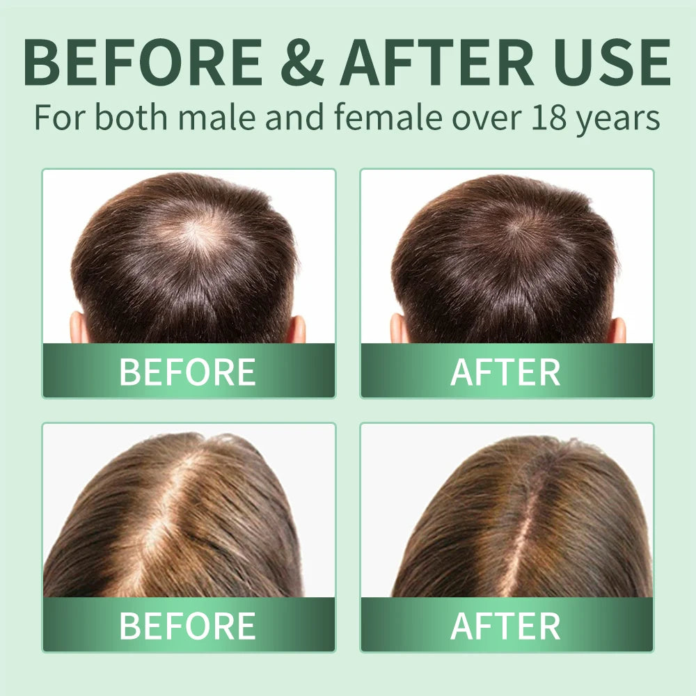 Rosemary & Scalp Wellness System